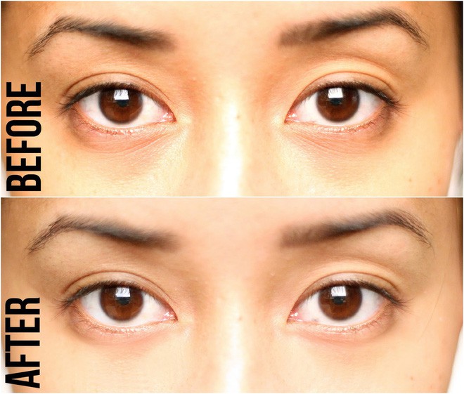 mặt nạ mắt | mặt nạ collagen đắp mắt | mask collagen genie